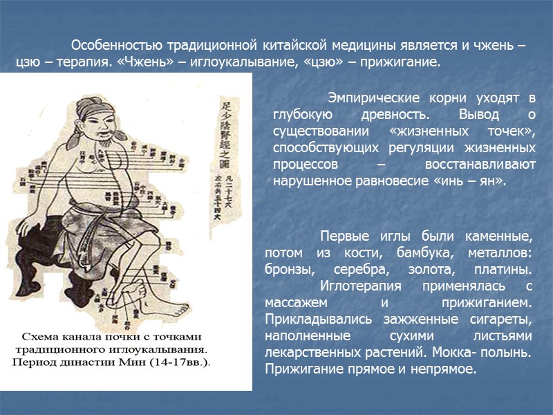 Особенностью традиционной китайской медицины является и чжень –цзю – терапия. «Чжень» – иглоукалывание, «цзю»